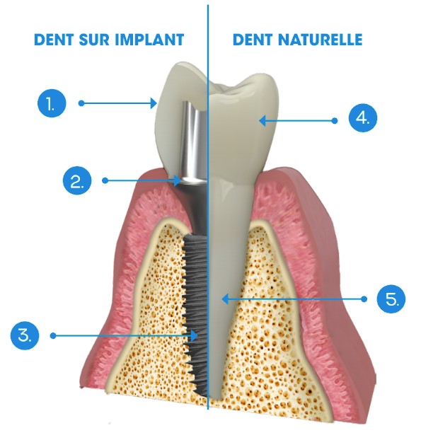 Implantation Cabinet Dentaire Les Dauphins à Baie-Mahault en Guadeloupe